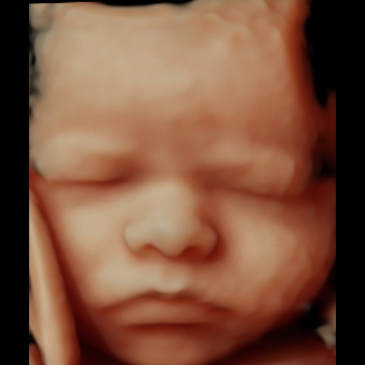 Before image