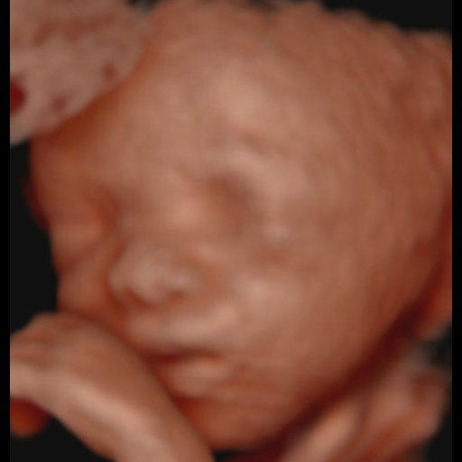 Before image