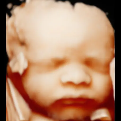 Before image