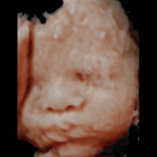 Before image