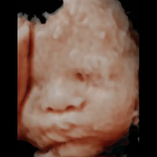 Before image