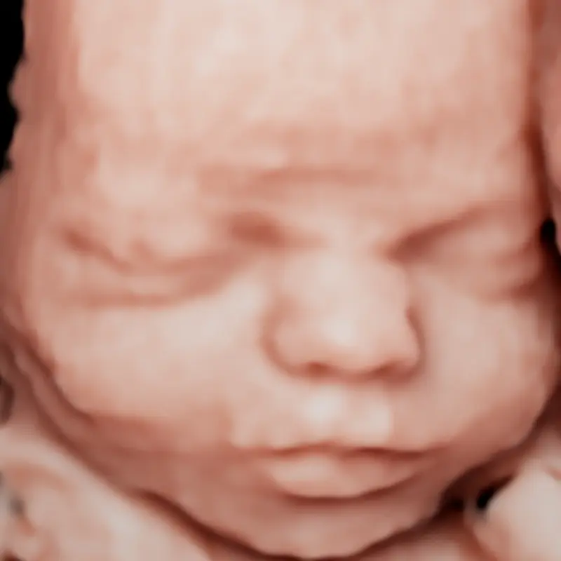 Before image